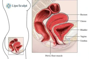 Treatment For A Leaky Bladder 2 How EM Chair treatment East Kilbride can help Leaky bladder issues. Read more now!